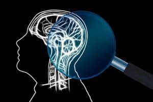 Cut section of the brain